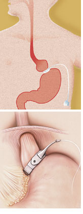 procedure