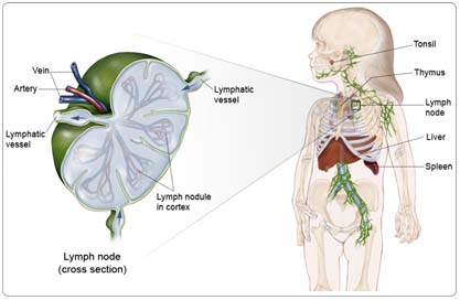 Lymphoma Non Hodgkin Childhood Cancer Surgery India